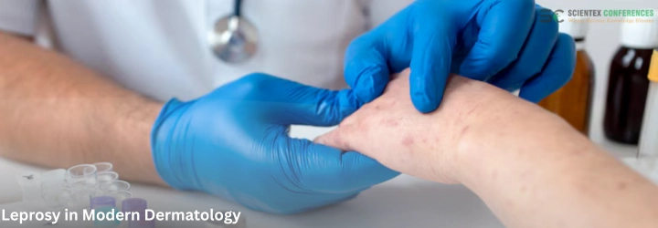 Leprosy in Modern Dermatology
