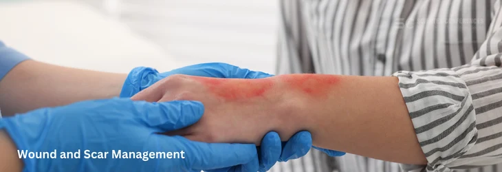 Wound and Scar Management